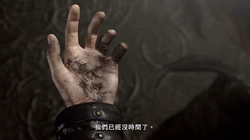 《生化9》裡昂病因為浣熊市綜合症? 玩家擔心其領便當