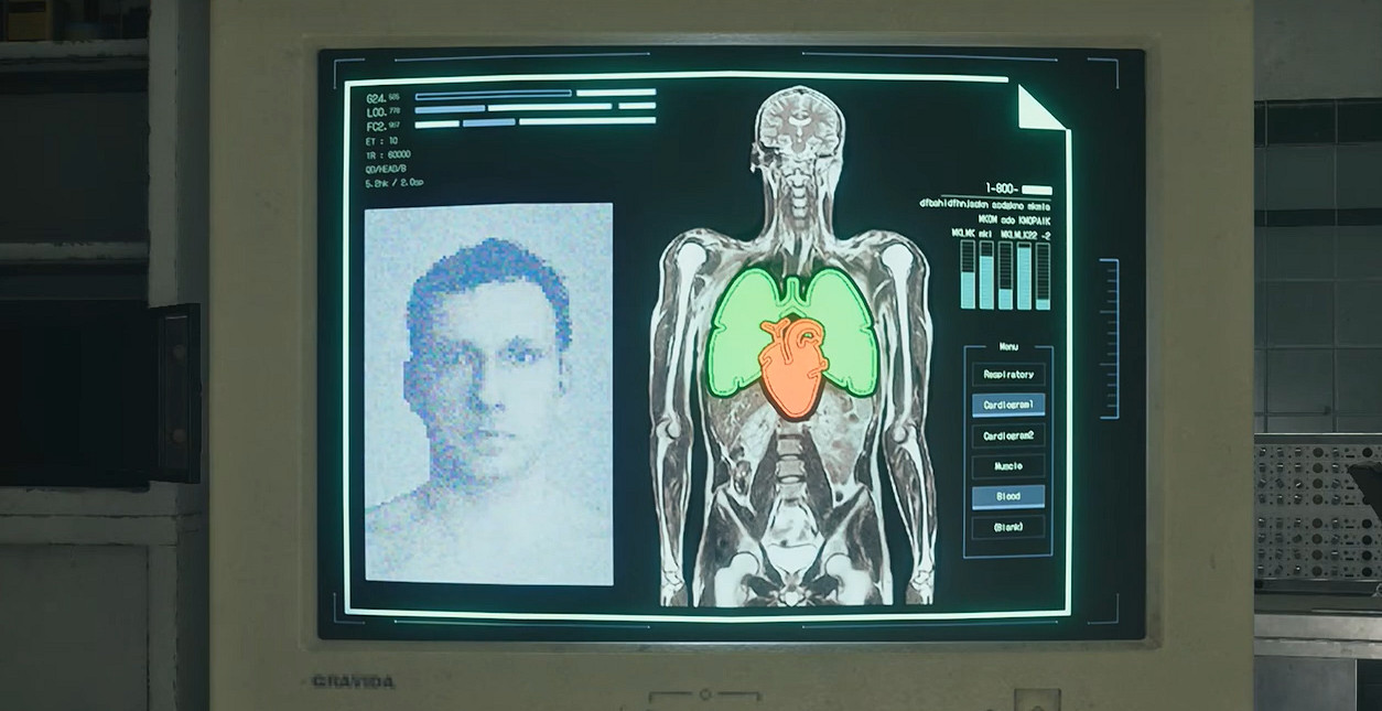 《惡靈古堡安魂曲》獲得二級安全識別腕帶方式